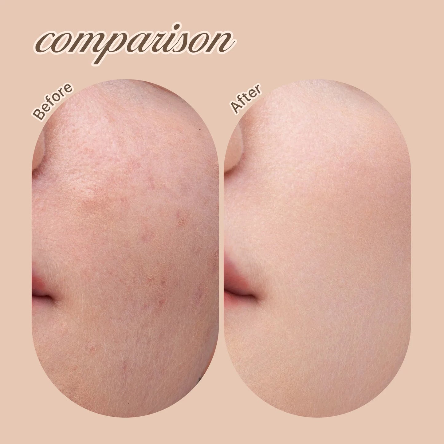 Stick Foundation